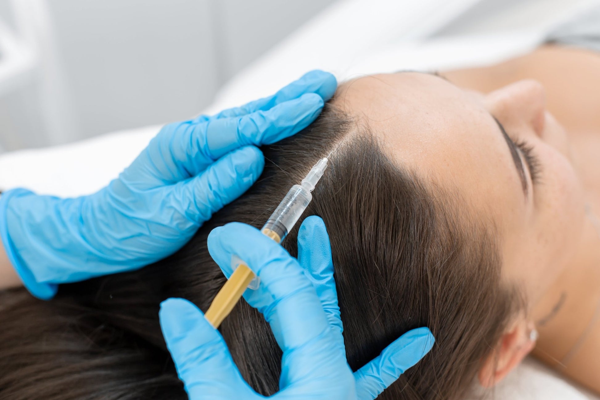 PRP Hair - Arisam Cosmetic Clinic